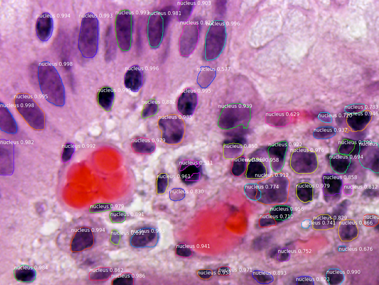 nucleus_segmentation.png